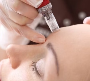 Dermapen