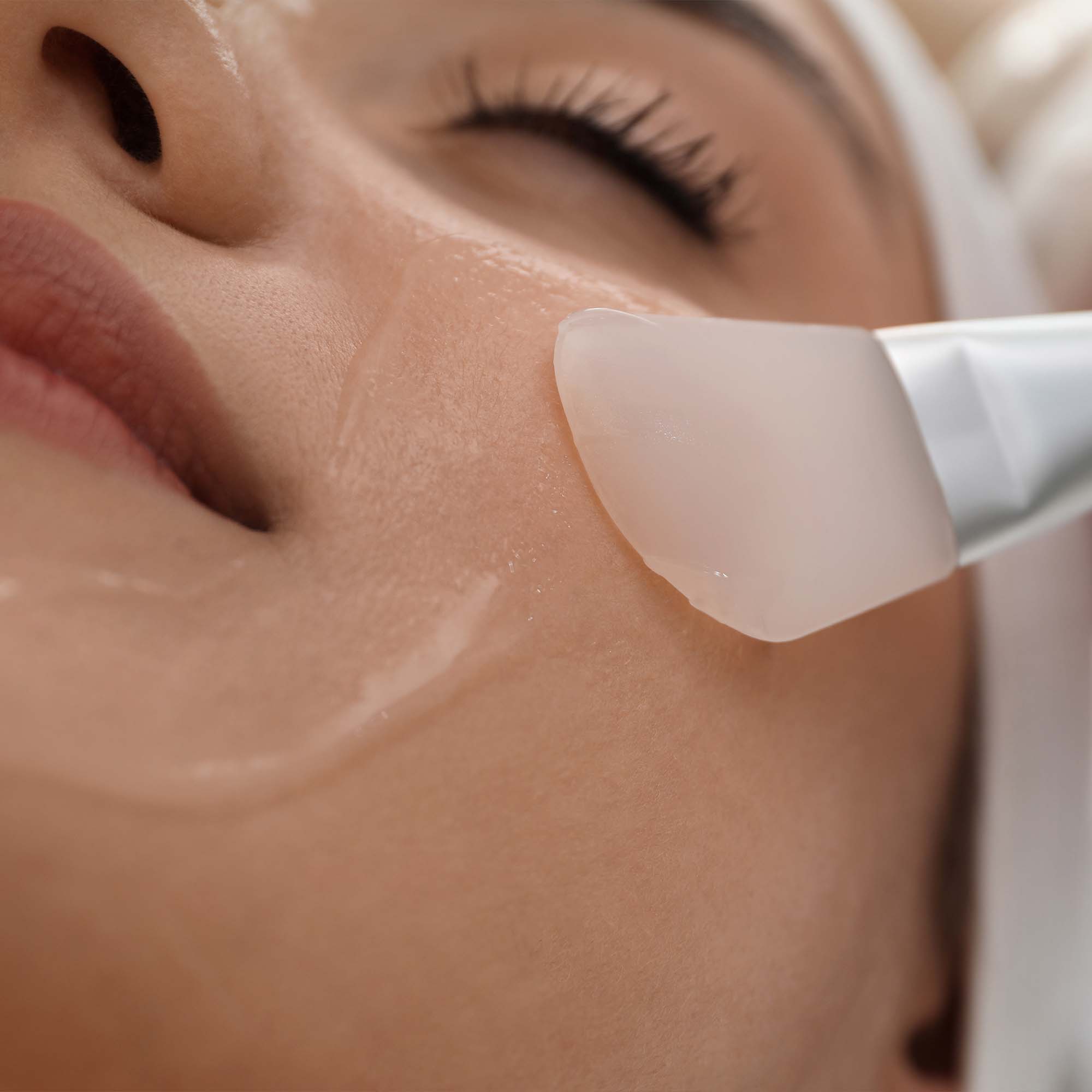 Soft Peeling